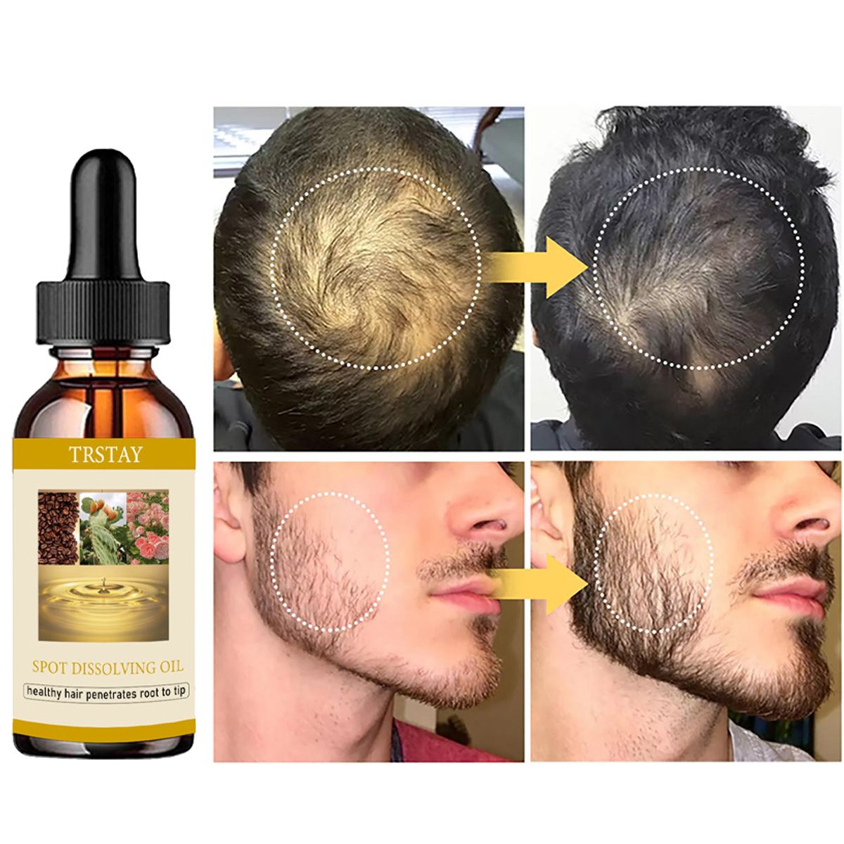 Эфирное масло для роста бороды – обзор и цена Beard Oil